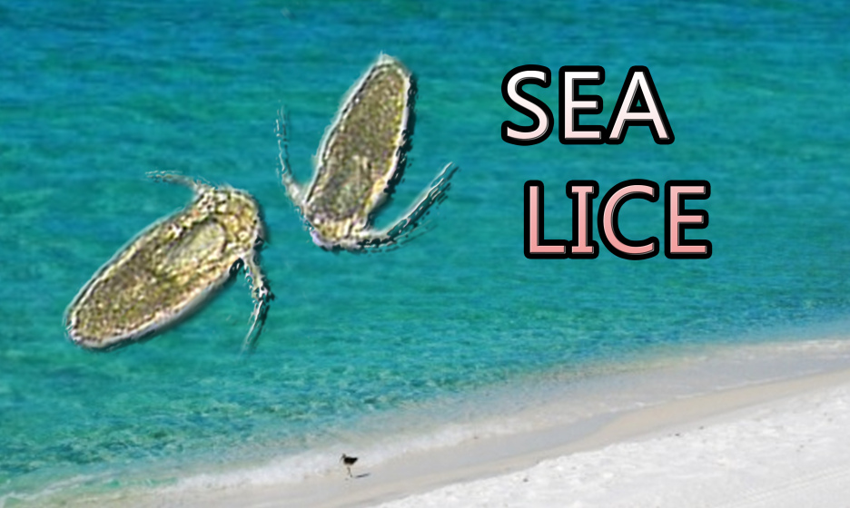 Beware of SEA LICE this SUMMER WZNSFM